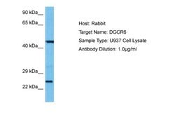 DGCR6 Rabbit anti-Human, Polyclonal, Novus Biologicals 0.1 mL | Buy Online | Novus Biologicals | Fisher Scientific